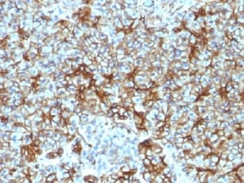 SPTBN2 Antibody (clone SPTBN2/1583, Azide-free, BSA-free)