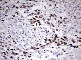CD5 Antibody (clone OTI10F4)