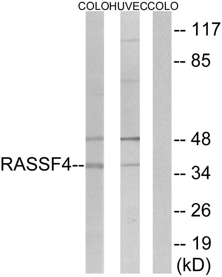 AD037 / RASSF4 Antibody