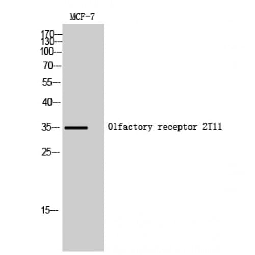 OR2T11 Antibody (30-110 aa, Internal)