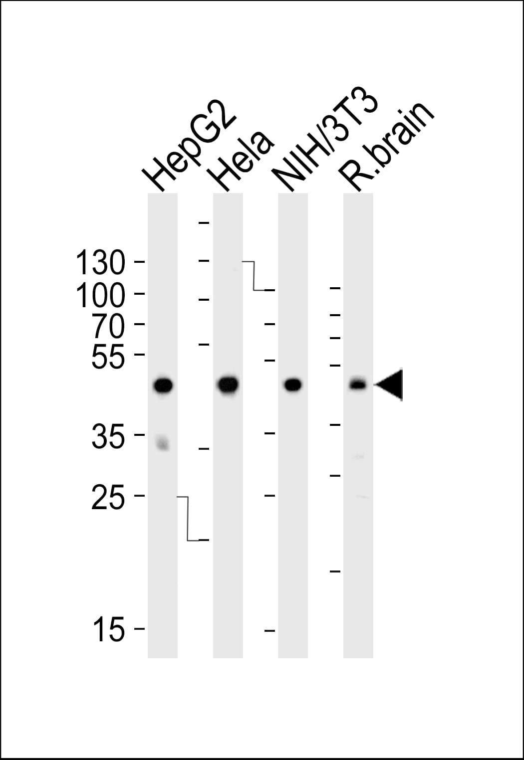 IHC-plus™ Polyclonal Rabbit anti-Human EFTU / TUFM Antibody (aa112-147, IHC, IF, WB)