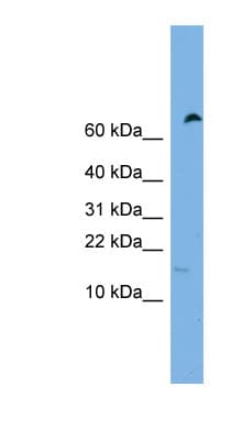 IFITM5 Antibody (C-Terminus)