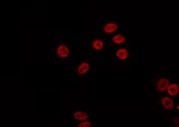 Polyclonal Rabbit anti-Human PARP2 Antibody (IF, WB)