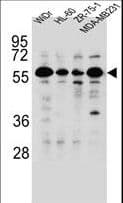 FOXC2 Antibody (aa183-210)