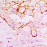 RNF144A / RNF144 Antibody (Internal)