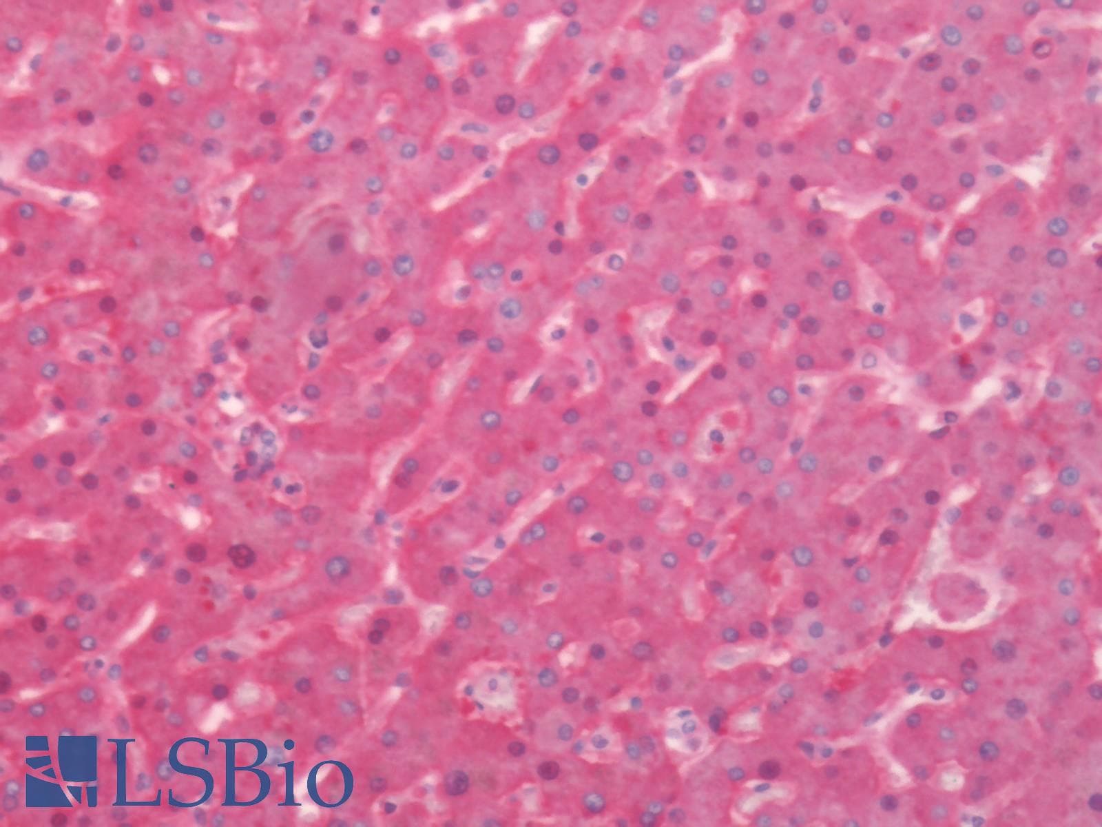 IHC-plus™ TF / Transferrin Antibody (clone 5G2)