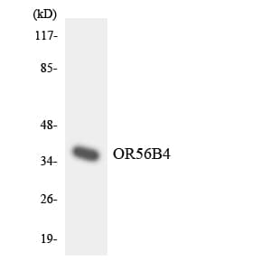 OR56B4 Antibody (aa228-277)