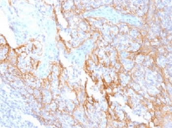 Monoclonal Mouse anti-Human CTNNB1 / Beta Catenin Antibody (clone 15B8, Azide-free,BSA-free, IHC, IF, WB)