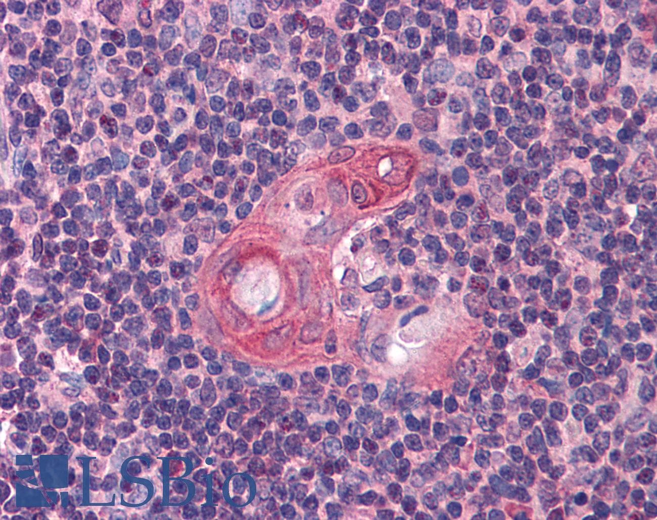 BCL11B Antibody (aa395-444)