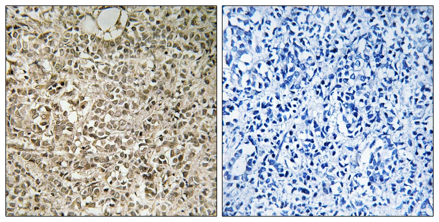 Polyclonal Rabbit anti-Human UBA52 Antibody (IHC)