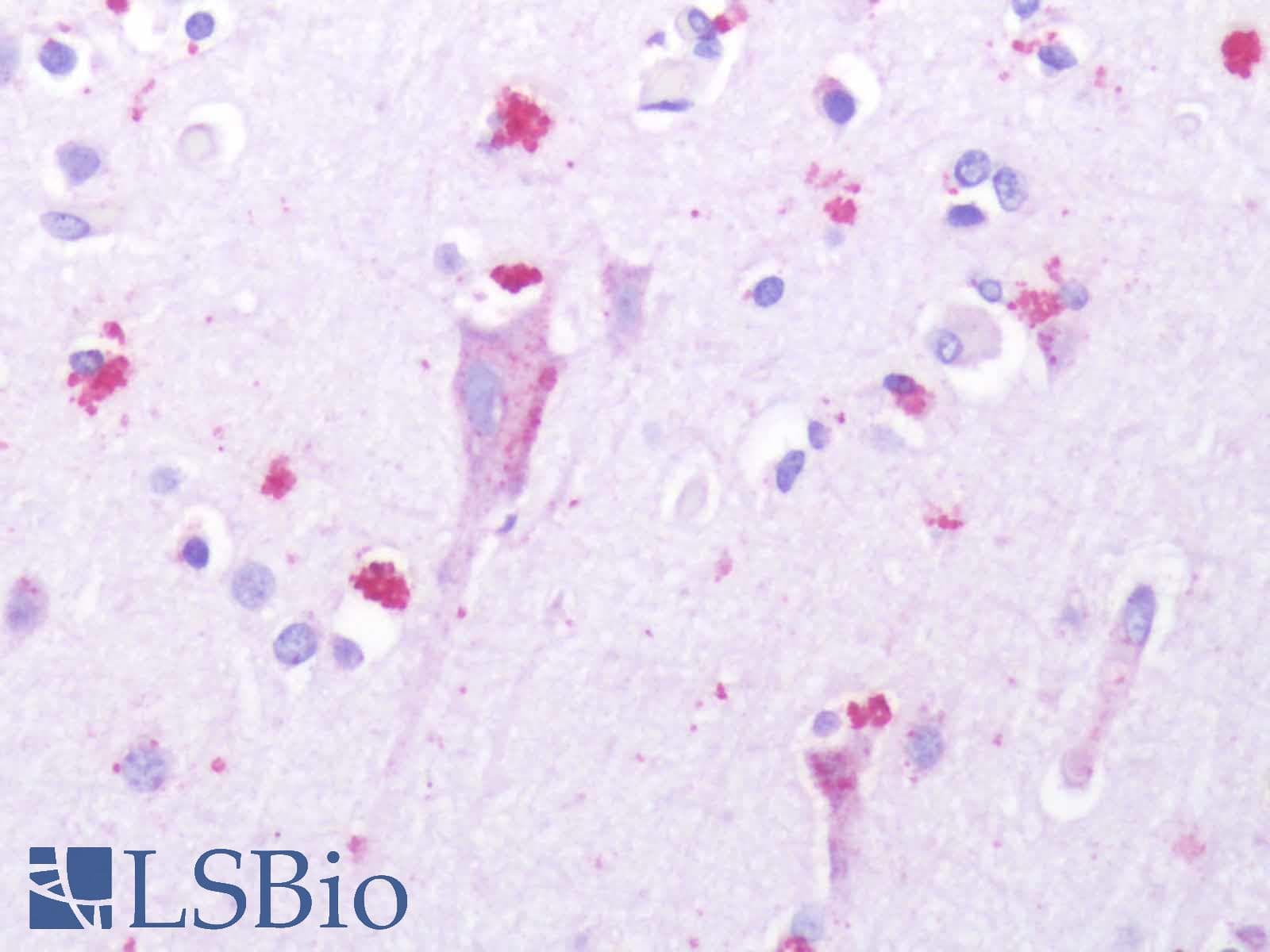 IHC-plus™ HTR1D / 5-HT1D Receptor Antibody (Extracellular Domain)