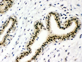 Polyclonal Rabbit anti-Human NBN / Nibrin Antibody (IHC, WB)