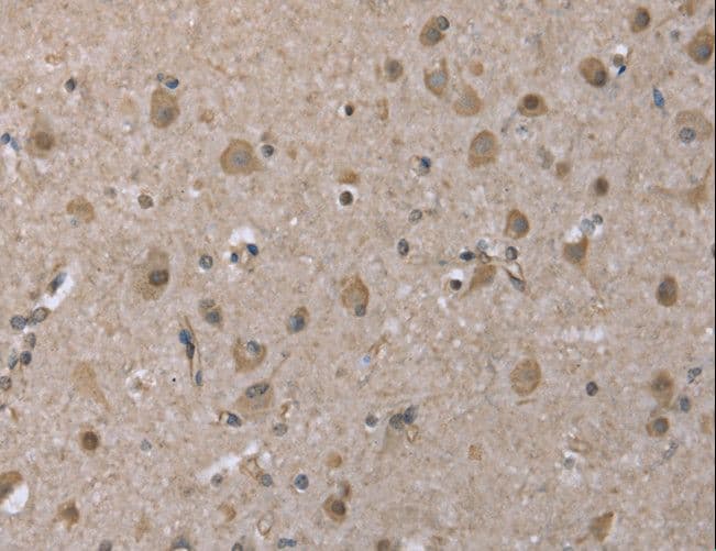 Polyclonal Rabbit anti-Human DYNLL1 / PIN Antibody (IHC, WB)