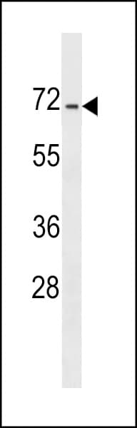 Polyclonal Rabbit anti-Human DACT3 Antibody (aa139-165, WB)