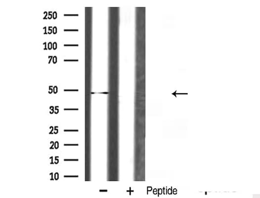 Polyclonal Rabbit anti-Human HNRNPH1 / hnRNP H Antibody (IF, WB)