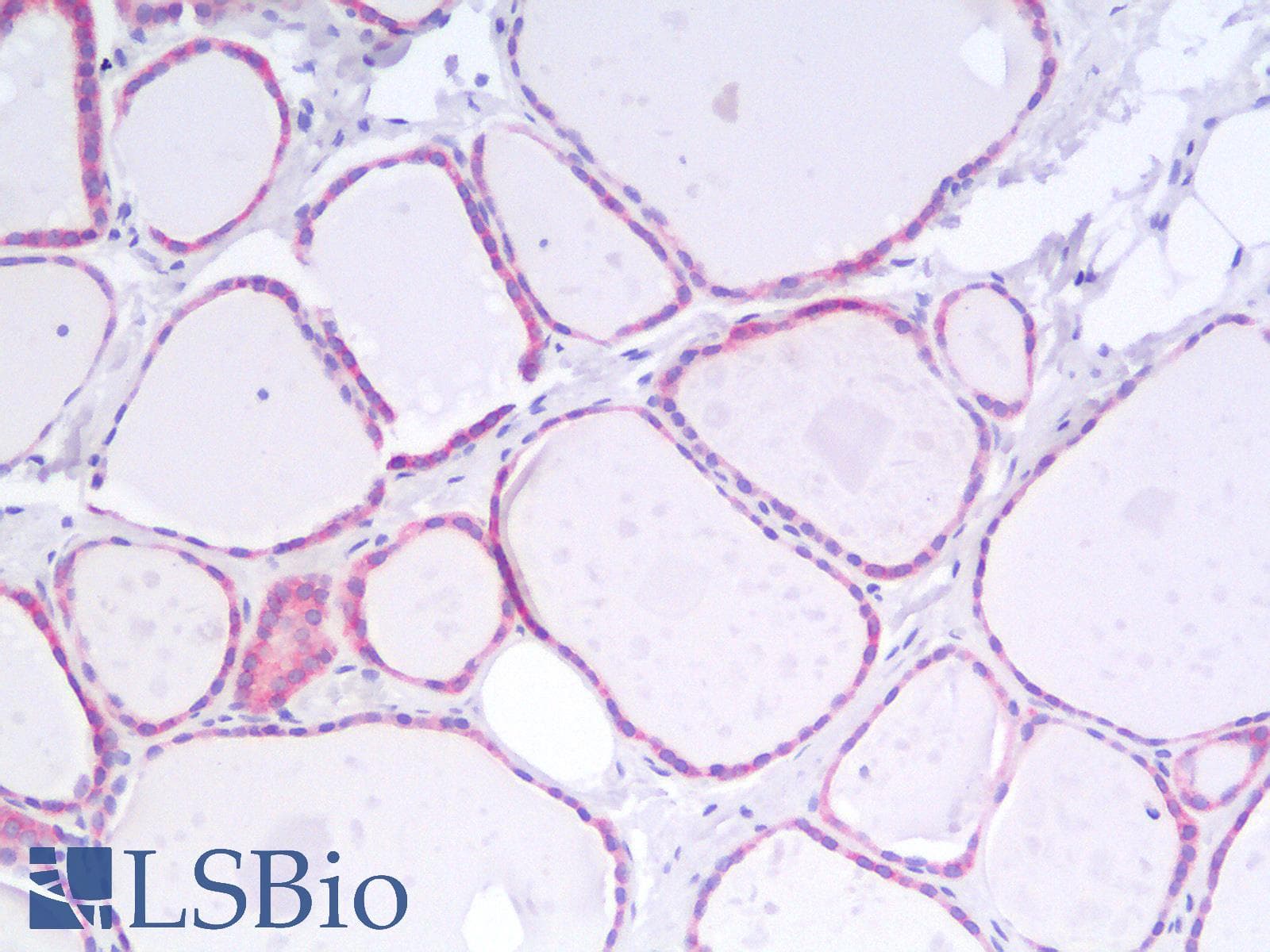 PathPlus™ BCL2 / Bcl-2 Antibody (clone rBCL2/796)