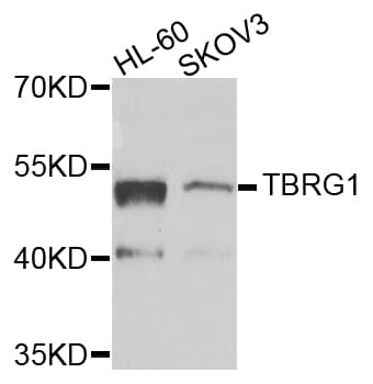 TBRG1 Antibody