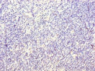 Polyclonal Rabbit anti-Human TRAT1 / TRIM Antibody (IHC)