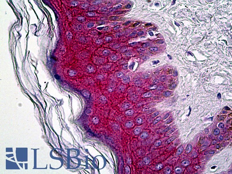 IHC-plus™ JUP/CTNNG/Junction Plakoglobin Antibody (C-Terminus)