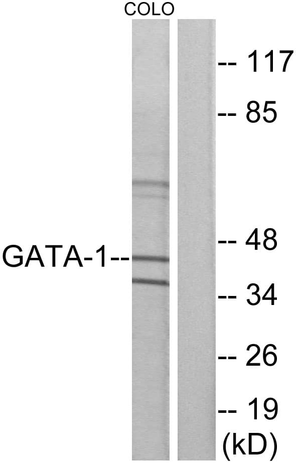 GATA1 Antibody (aa109-158)