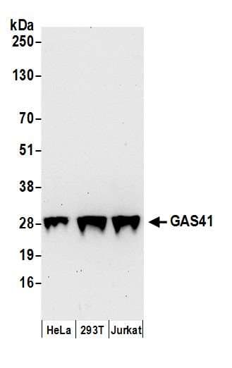 GAS41 Antibody (aa177-227)