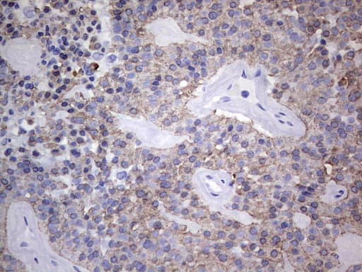 Acidic Cytokeratin Antibody (clone 8A3)