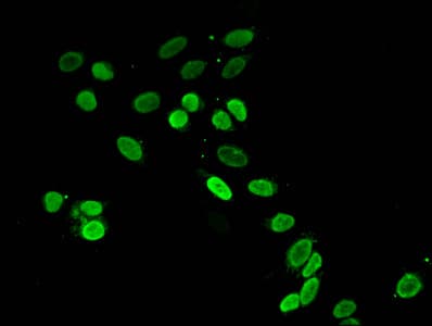 Polyclonal Rabbit anti-Human HIST1H4I Antibody (IHC, IF, WB)