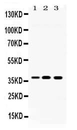 Polyclonal Rabbit anti-Human LDHA / LDH1 Antibody (IHC, WB)