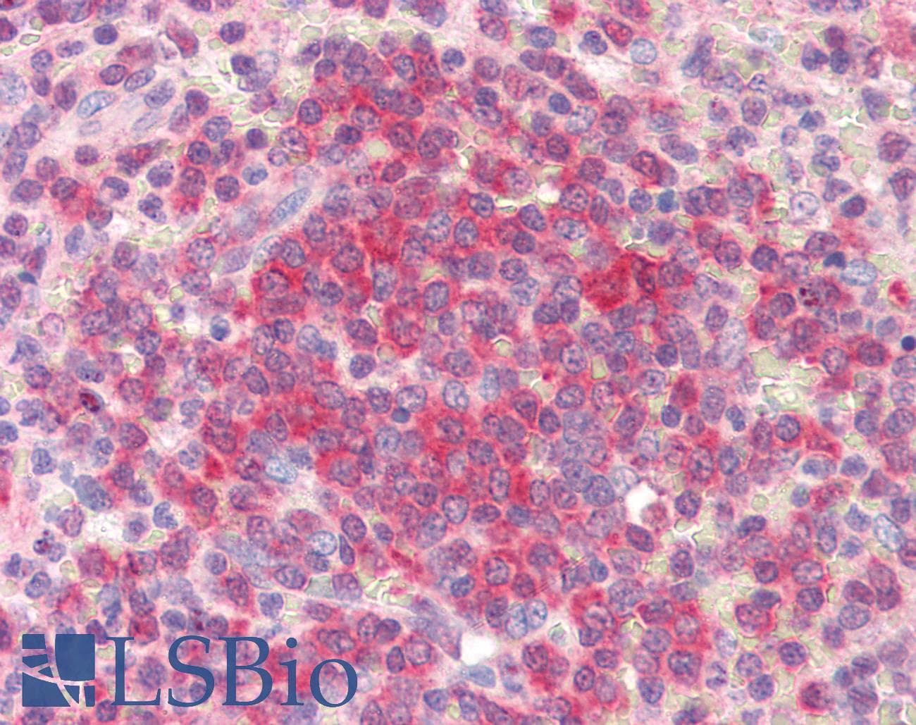 IHC-plus™ UBE2L6 Antibody (aa1-152, clone K1H3)