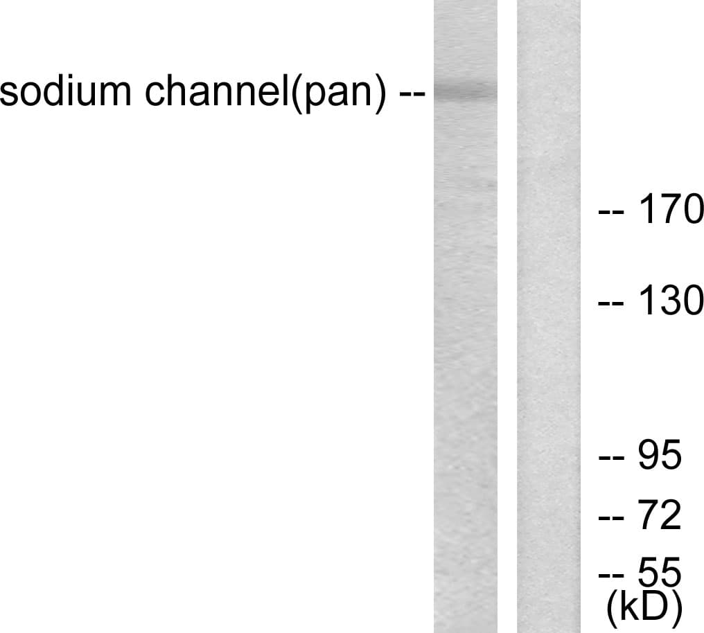 Sodium Channel Antibody (aa1466-1515)