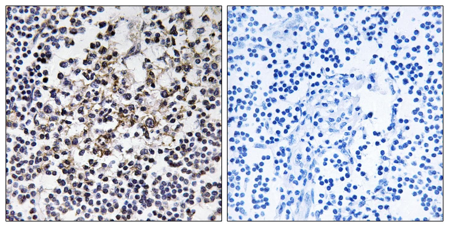 Polyclonal Rabbit anti-Human PGLS / 6PGL Antibody (IHC, WB)