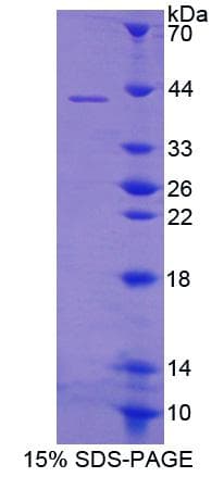 Human BCMP84 / S100A14 Protein (Recombinant His-GST)