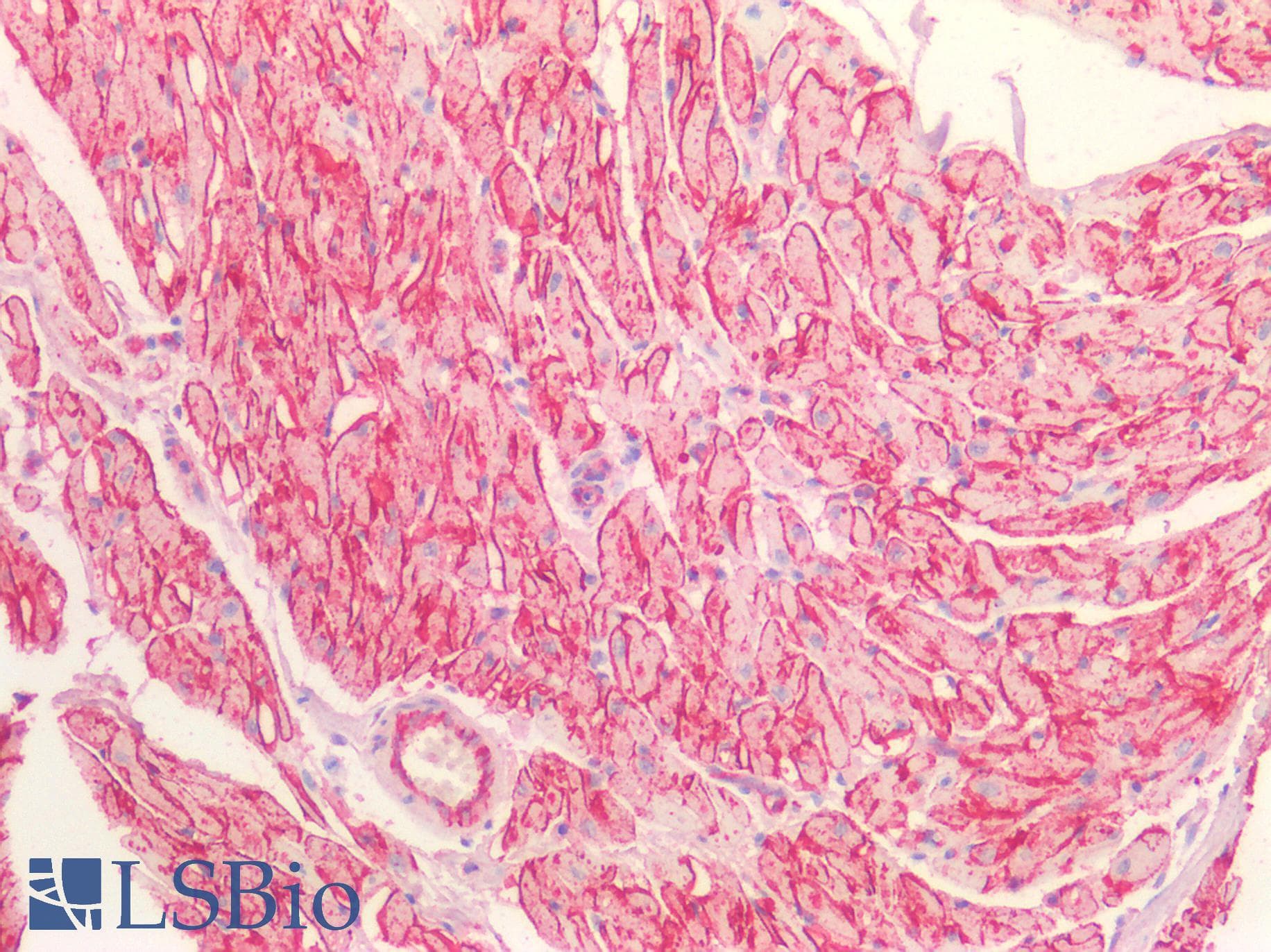 IHC-plus™ CDH13 / Cadherin 13 Antibody
