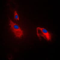 PFKP Antibody (Internal)