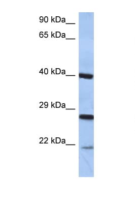 CIDEB Antibody (C-Terminus)