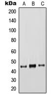 IHC-plus™ KRT18 / CK18 / Cytokeratin 18 Antibody (C-Terminus)