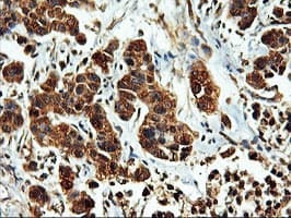ERGIC-53 / LMAN1 Antibody (clone OTI1C5)
