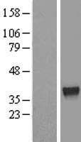 ZNF330 Protein (Over-Expression Lysate Myc-DDK (Flag))
