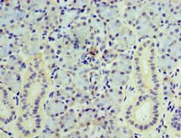 VAMP3 / VAMP-3 Antibody (aa1-80)