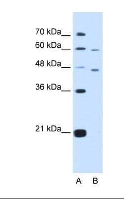 Polyclonal Rabbit anti-Human CRELD1 Antibody (aa311-360, IHC, WB)