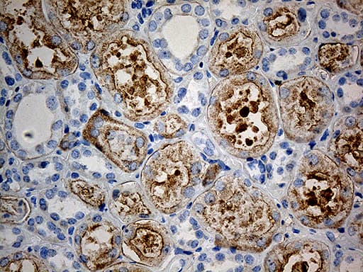 KBTBD4 Antibody (clone OTI2B6)