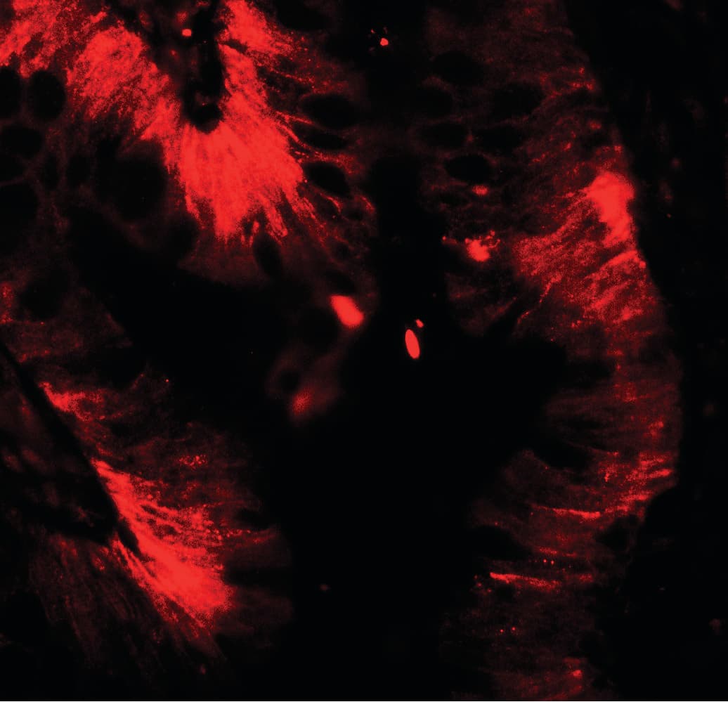IHC-plus™ CLDN4 / Claudin 4 Antibody