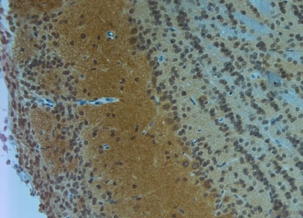 Polyclonal Rabbit anti-Human CLVS1 Antibody (aa300-354, IHC, WB)