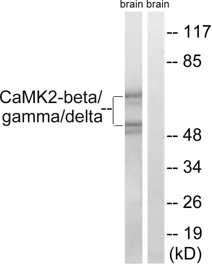 CaMKII Beta+Gamma+Delta Antibody (Internal)