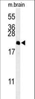 Polyclonal Rabbit anti-Human NAP1L5 Antibody (aa82-111, WB)