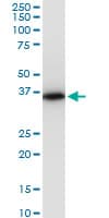 PRSS8 / Prostasin Antibody (clone 3C4)