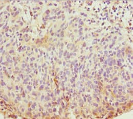 Polyclonal Rabbit anti-Human ABCB8 Antibody (IHC)