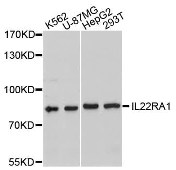 Polyclonal Rabbit anti-Human IL22RA1 / IL22R Antibody (WB)