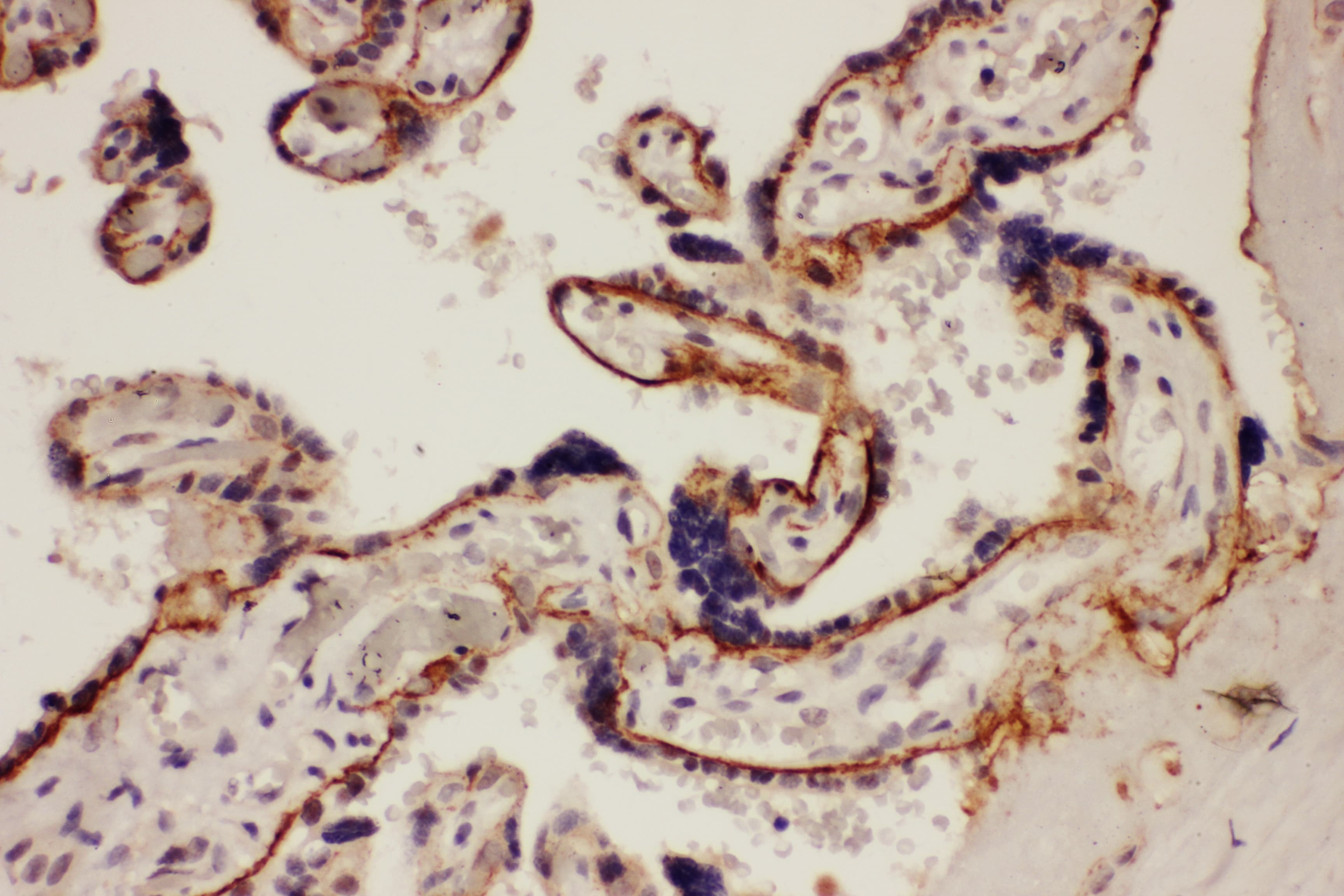 ITGB4 / Integrin Beta 4 Antibody (aa28-266)