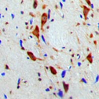 SMG7 Antibody (Internal)